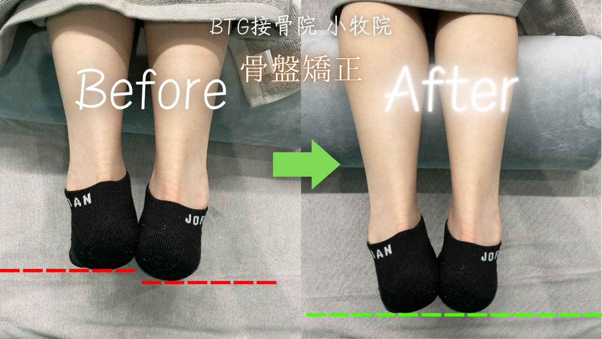 ビフォーアフター 6