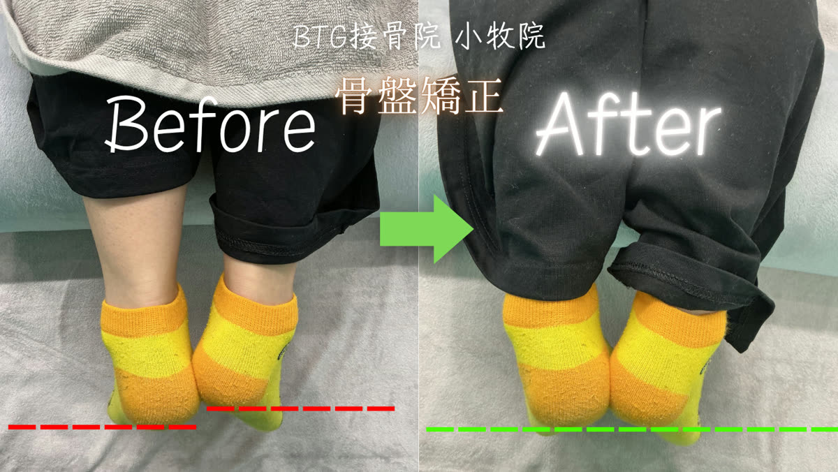 ビフォーアフター 7