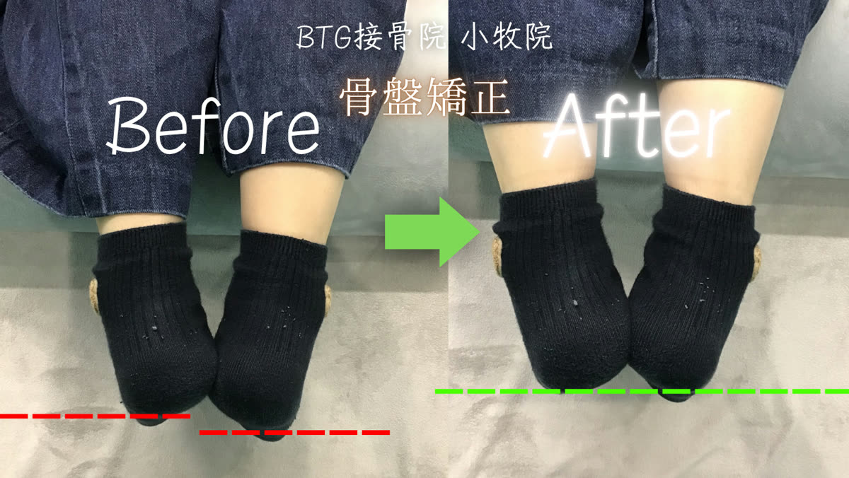 ビフォーアフター 9